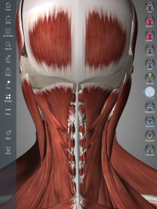 Widok na mięśnie podpotyliczne (opcja "Hide" na mięśniu czworobocznym)
